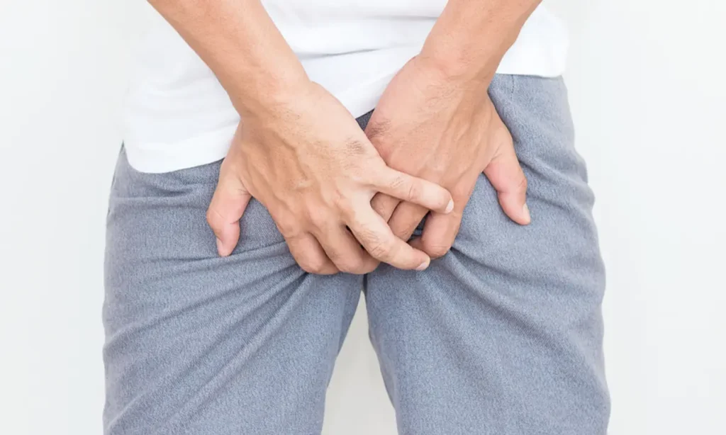 Tratando Hemorroida no Consultório